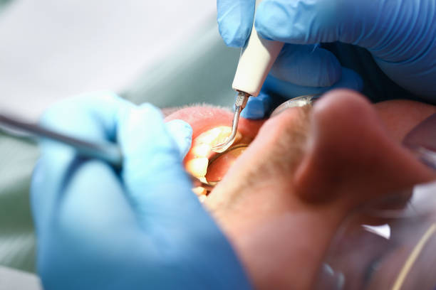 Best Broken Tooth Emergency  in University Of Virginia, VA