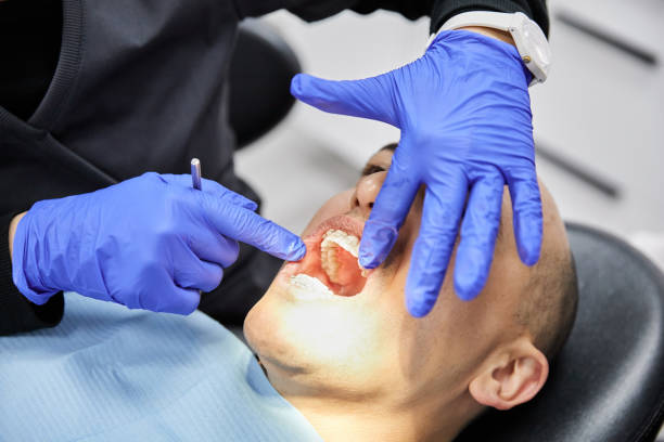 Best Dentist for Tooth Abscess  in University Of Virginia, VA