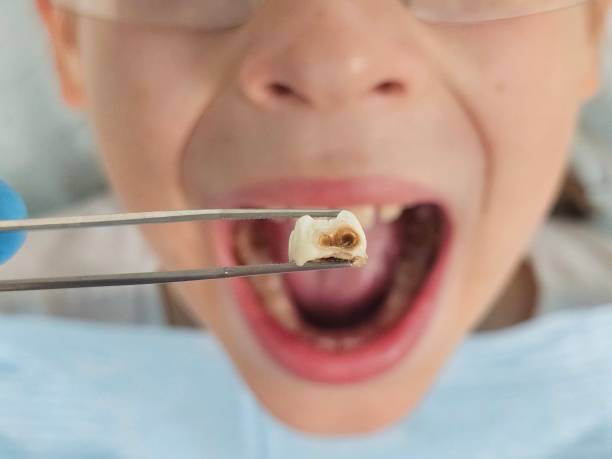 Best Emergency Dentist Open Today  in University Of Virginia, VA