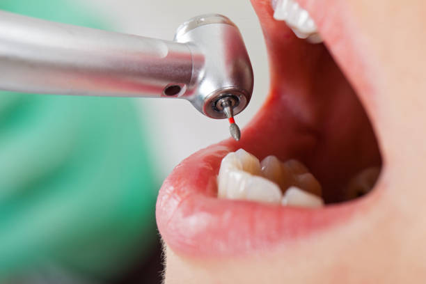Best Cracked Tooth Emergency Dentist  in University Of Virginia, VA